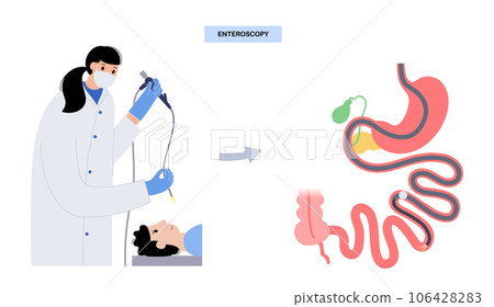 Esophagogastroduodenoscopy medical procedure - Stock Illustration ...