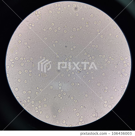 Fresh bacteria cell in urine sample. Fresh bacteria cell in urine sample. 106436003