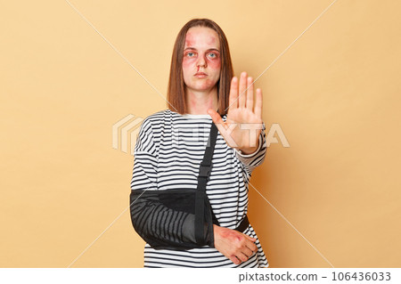 Serious strict woman with scratches and bruises on face with bandage wearing striped shirt standing isolated over beige background showing stop gesture asking to stop violence. 106436033