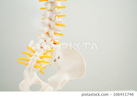 Spinal nerve and bone, Lumbar spine displaced herniated disc fragment, Model for treatment medical in the orthopedic department. Spinal nerve and bone, Lumbar spine displaced herniated disc fragment, Model for treatment medical in the orthopedic department. 106451746