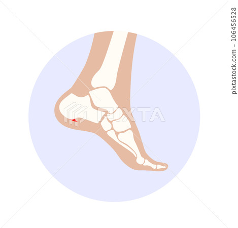 Heel spur icon Heel spur icon 106456528