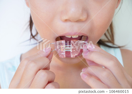 Children's orthodontic appliance 106460015