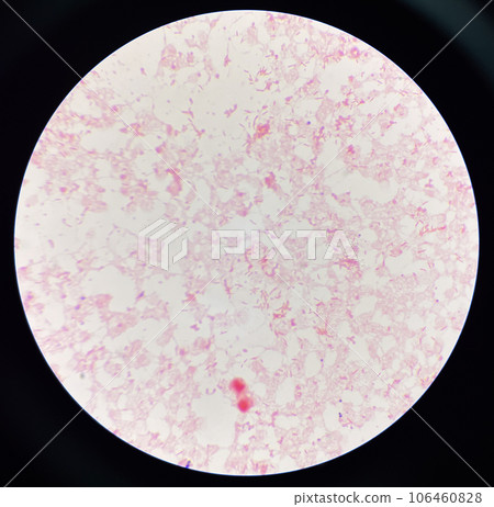 Red cell gram negative bacilli in hemo culture. 106460828