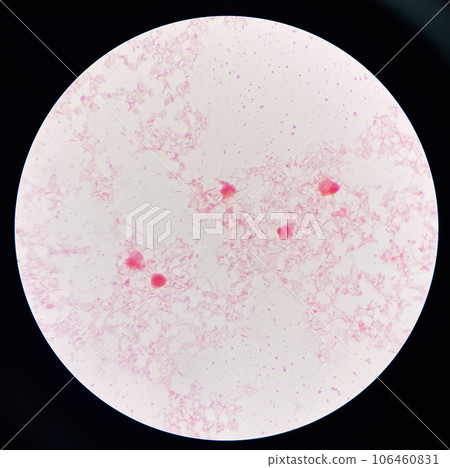 Red cell gram negative bacilli in hemo culture. Red cell gram negative bacilli in hemo culture. 106460831