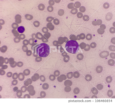 Blast cell 106460854