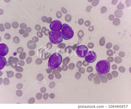 Blast cell Blast cell 106460857