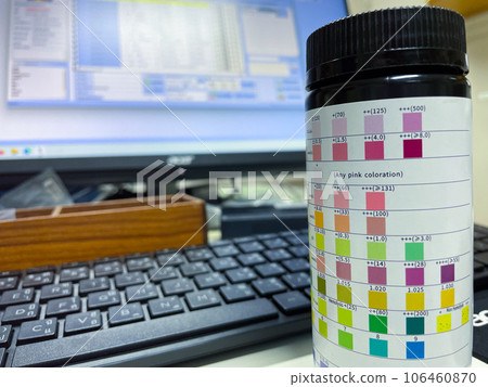 Urine analysis 106460870