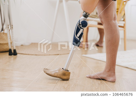 Closeup disability people leg using modern technology prosthetics bionic leg or light weight prosthetic limbs for athlete. 106465676
