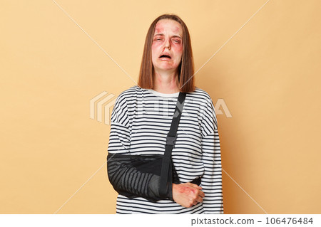 Despair sad unhappy woman with scratches and bruises on face with bandage wearing striped shirt standing isolated over beige background cryinh after get traumas after husband's abuse. Despair sad unhappy woman with scratches and bruises on face with bandage wearing striped shirt standing isolated over beige background cryinh after get traumas after husband's abuse. 106476484