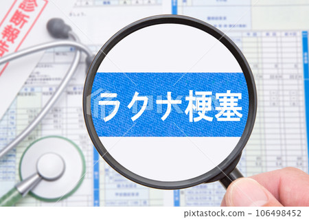 腔隙性腦梗塞醫學圖像 腔隙性腦梗塞醫學圖像 106498452