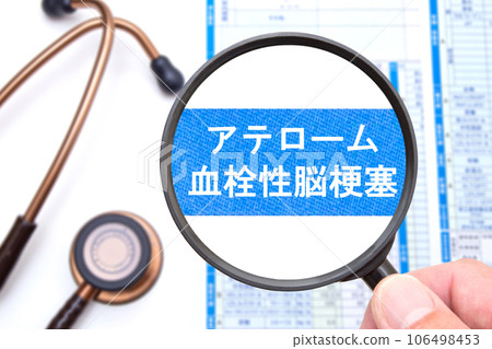 動脈粥樣硬化血栓性腦梗塞醫學圖像 106498453