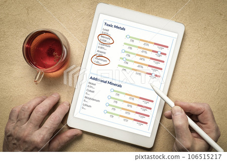 reviewing medical test results on a digital tablet - toxic metals and other minerals with high levels of mercury and aluminum from a hair sample reviewing medical test results on a digital tablet - toxic metals and other minerals with high levels of mercury and aluminum from a hair sample 106515217