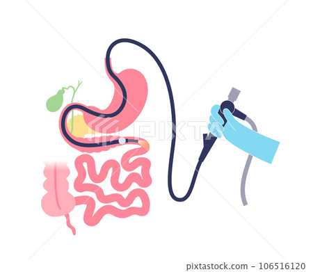 Esophagogastroduodenoscopy medical procedure 106516120
