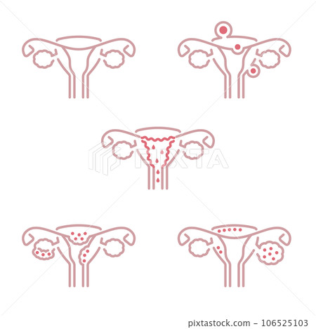 子宮簡單線條畫圖標集-前視圖 106525103