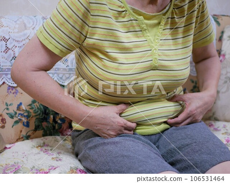 患有肥胖症的老年婦女 患有肥胖症的老年婦女 106531464