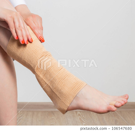 The girl puts on an elastic orthopedic knee pad on a sore leg. Arthrosis and knee injury. Fixation of the knee joint. Copy space for text 106547680
