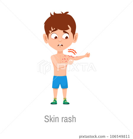 Child with skin rash disease. Isolated vector sick boy with itchy red spots on skin. Eczema, dermatitis dermatology sickness symptoms. Infection or allergic reaction Child with skin rash disease. Isolated vector sick boy with itchy red spots on skin. Eczema, dermatitis dermatology sickness symptoms. Infection or allergic reaction 106549811