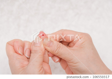 [Diabetes blood sugar level measurement blood] 106550317