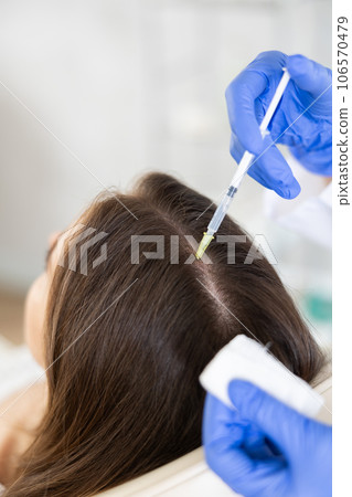 Hands of trichologist performing injections into scalp to female patient 106570479
