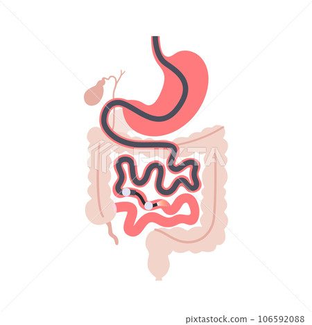 Double balloon enteroscopy 106592088