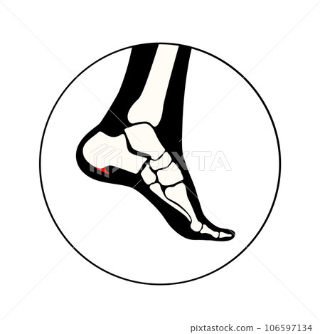 Heel spur icon 106597134