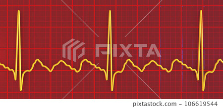ECG in atrial flutter, 3D illustration 106619544