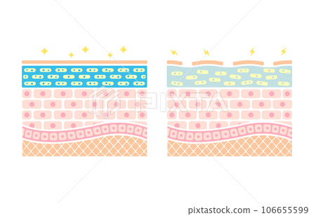 Skin cross-section comparison illustration of healthy skin and dry skin (no text) 106655599