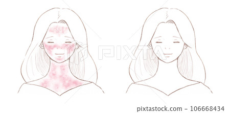 一名患有紅臉皮膚病的婦女和一名已完全治癒的婦女 背景上的透明線條畫 106668434