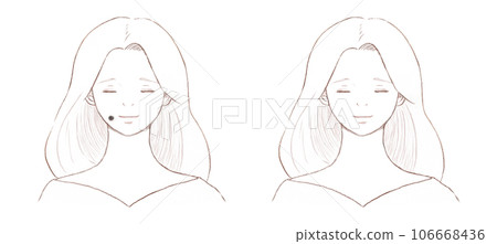 一名患有大而明顯的黑痣的婦女和一名已去除痣的婦女在透明背景上畫線 一名患有大而明顯的黑痣的婦女和一名已去除痣的婦女在透明背景上畫線 106668436