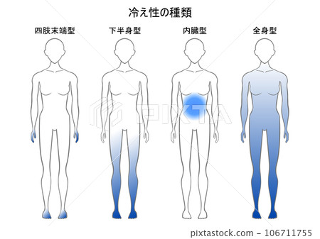 對寒冷敏感的類型 106711755