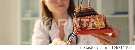 Young female dermatologist holds pen and anatomical model of human skin with hair. Young female dermatologist holds pen and anatomical model of human skin with hair. 106715196