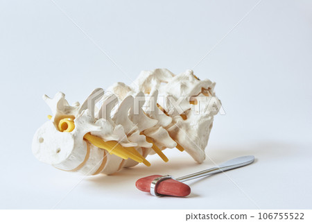 Lumbar spine model and reflex hammer  106755522