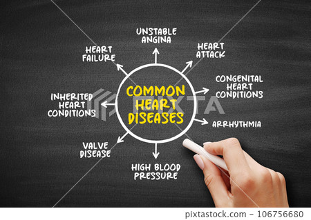 Common heart diseases mind map text concept for presentations and reports Common heart diseases mind map text concept for presentations and reports 106756680