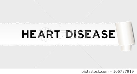 Ripped gray paper background that have word heart disease under torn part 106757919