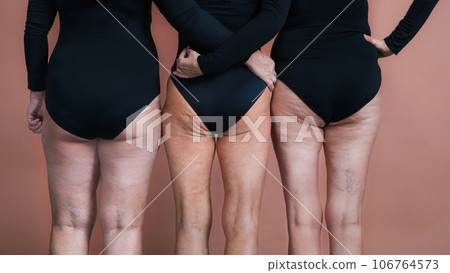 Rear view of three senior friends holding each other, close up on female legs. Rear view of three senior friends holding each other, close up on female legs. 106764573