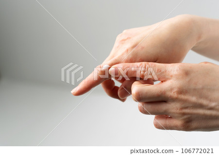手部粗糙皮膚病 106772021