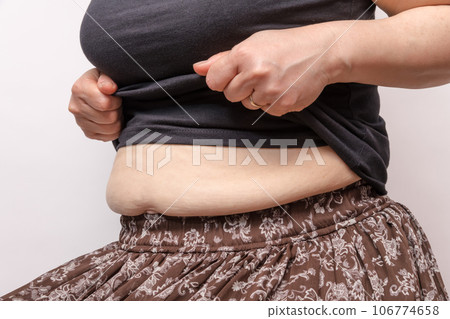 [德貝索與代謝綜合徵家庭主婦] 106774658