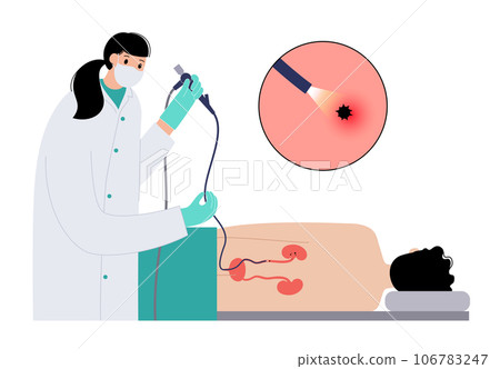 Ureteroscopy medical poster 106783247