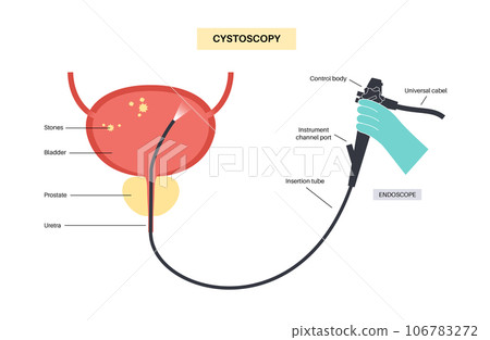 Cystoscopy examination concept 106783272