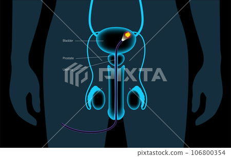 Cystoscopy examination concept 106800354