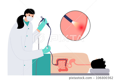 Colonoscopy medical procedure 106800362