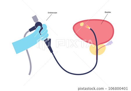 Cystoscopy examination concept 106800401