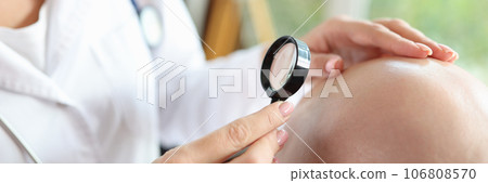 Female doctor checks scalp of bald male patient while looking through magnifying glass. 106808570