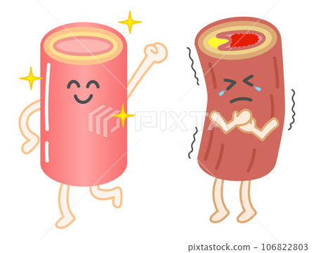 Illustration with facial expressions of healthy blood vessels and blood vessels occluded by arteriosclerosis 106822803