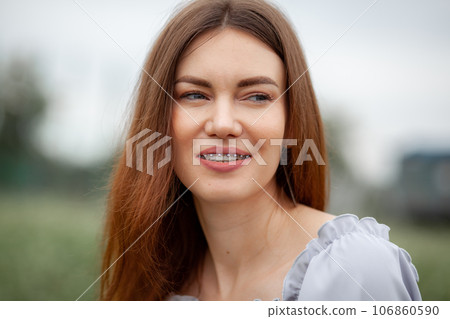 The smile of a young and beautiful girl with braces on her white teeth. Straightening of crooked teeth with the help of a bracket system. Malocclusion. Dental care. Smooth teeth and a beautiful smile 106860590