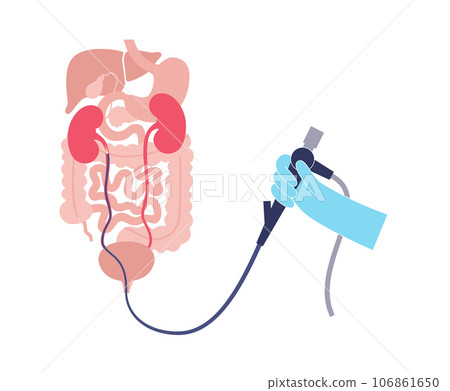 Ureteroscopy medical poster 106861650