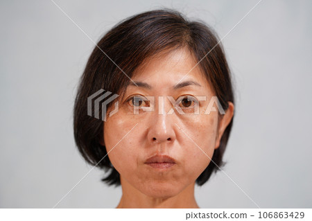 A middle-aged woman with an aging face with spots and wrinkles, looking at the camera 106863429