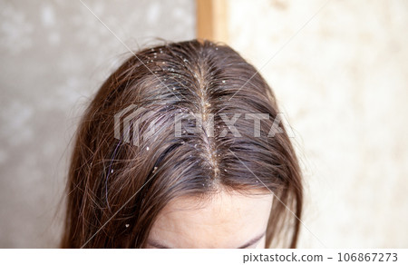 Parting of women's hair on the head. Hair care and care. Closeup of a woman's head with parted gray hair regrown roots becouse of quarantine 106867273