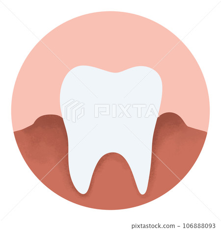 Tartar and bactrail tooth plaque, lower jaw. Medically accurate  illustration of human teeth treatment 106888093