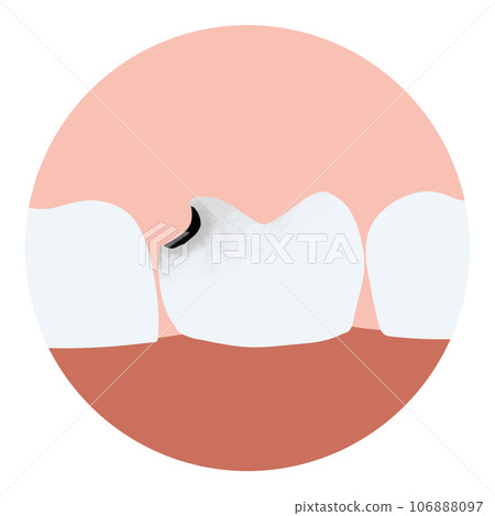 Tooth anatomy decay caries toothache dental... - Stock Illustration ...